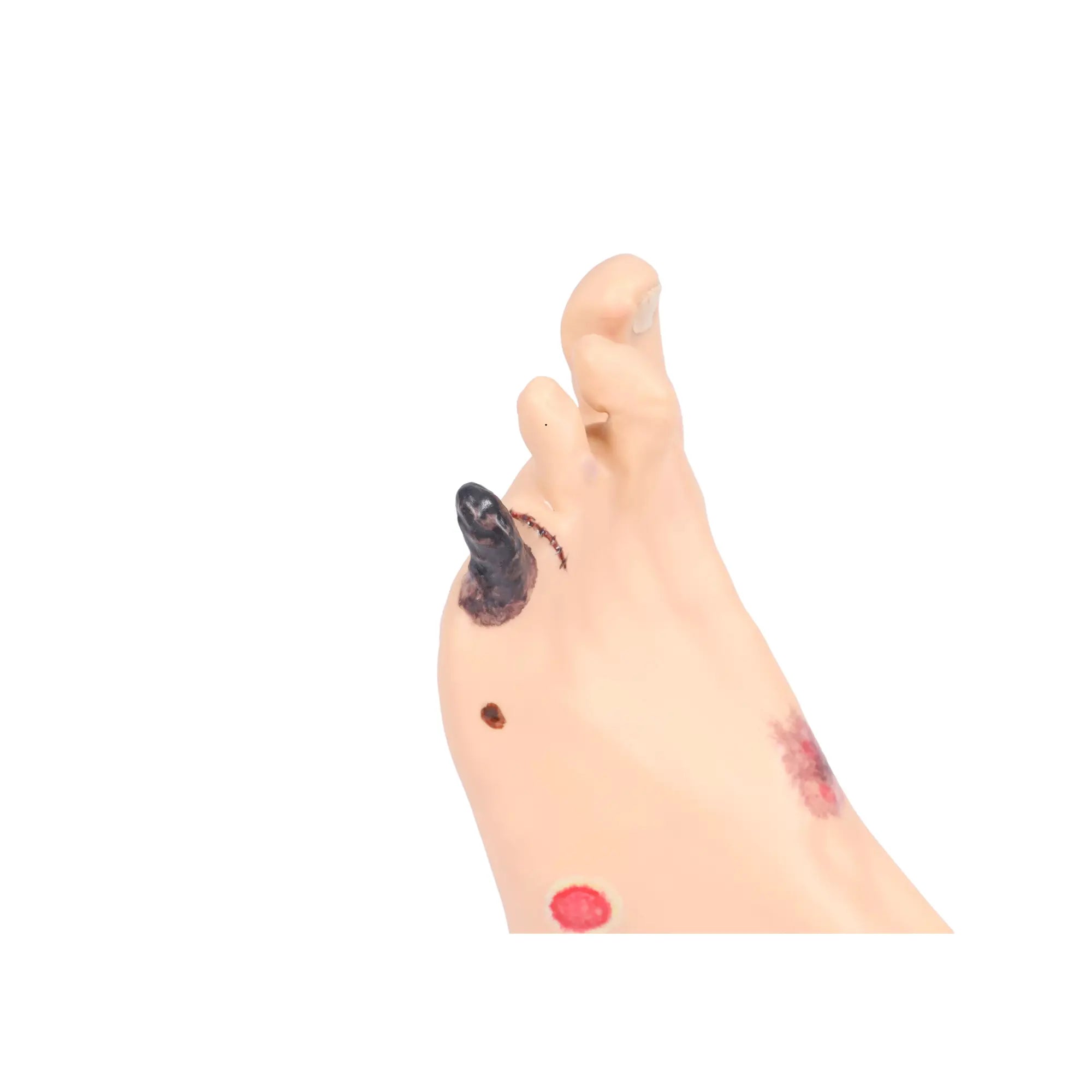 Modèle de pied avec plaies - Anatomie et pathologie My Podologie 