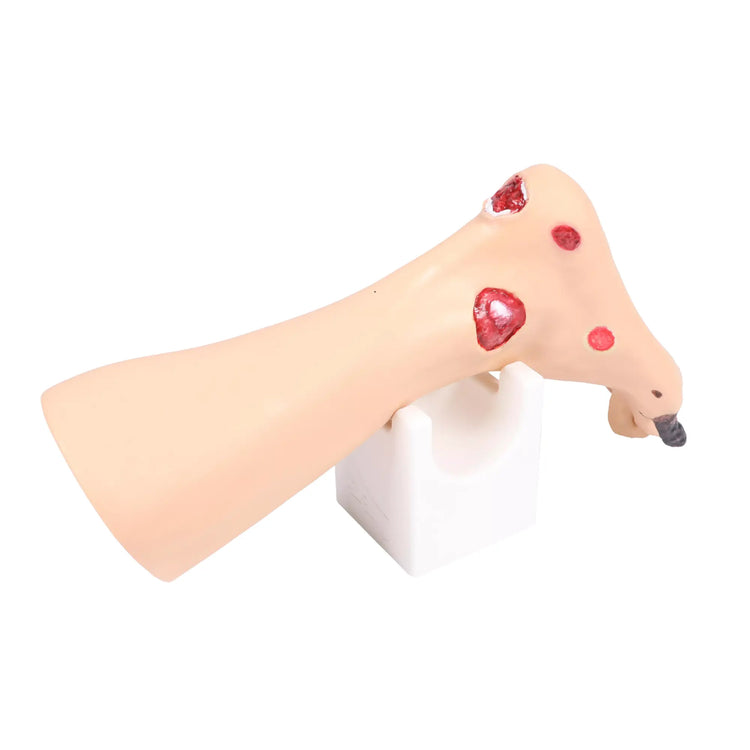 Modèle de pied avec plaies - Anatomie et pathologie My Podologie 