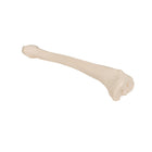 Tibia - Anatomy and pathology